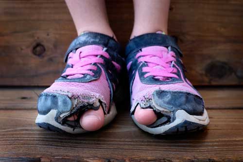 girl's toes sticking through holey shoes